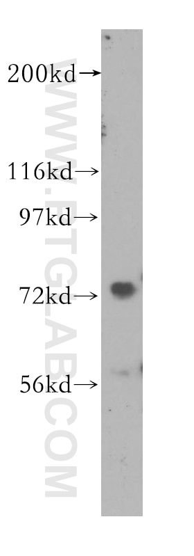 Western Blot (WB) analysis of K-562 cells using MEPCE Polyclonal antibody (11526-1-AP)