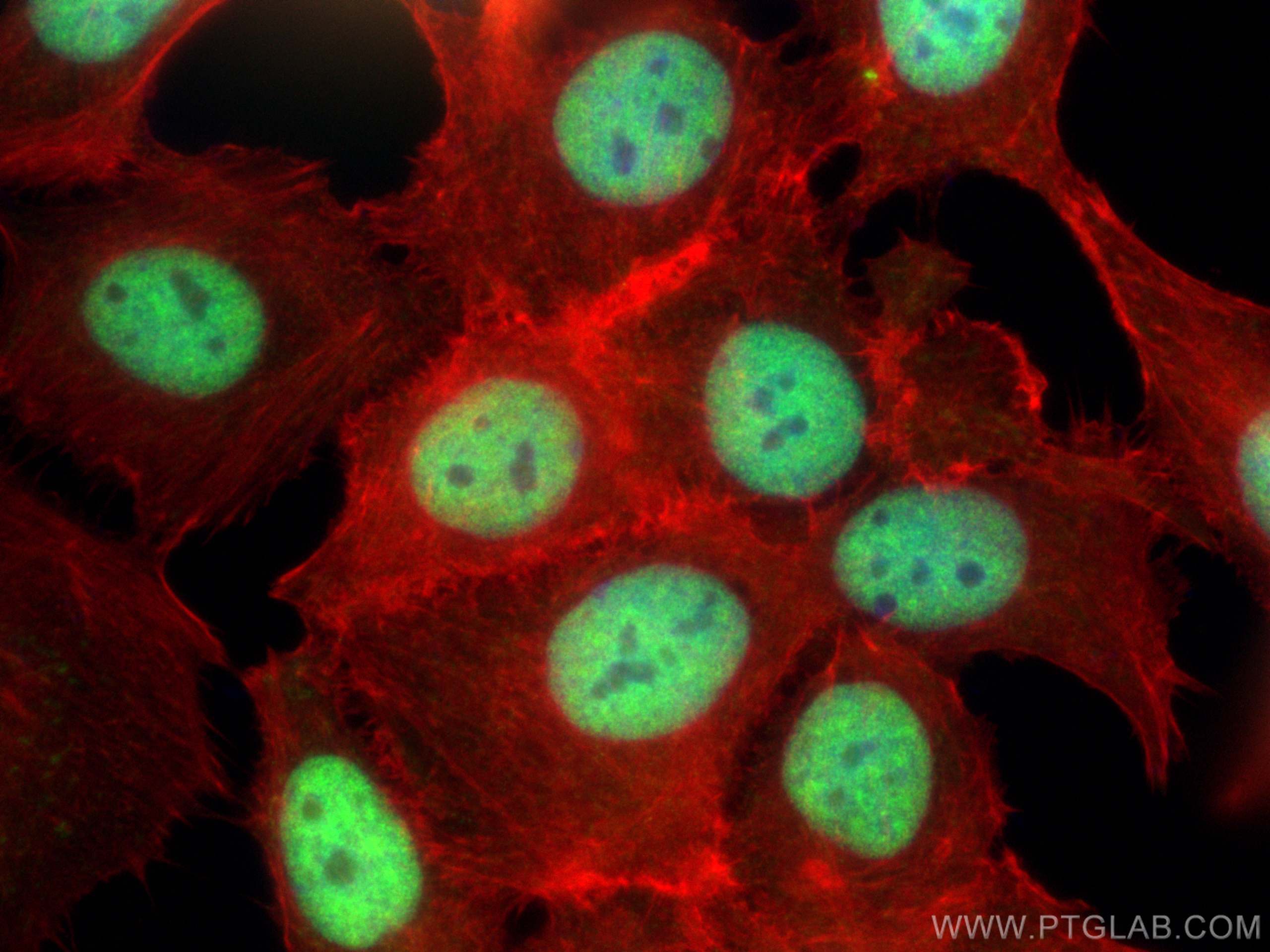 IF Staining of MCF-7 using 14917-1-AP