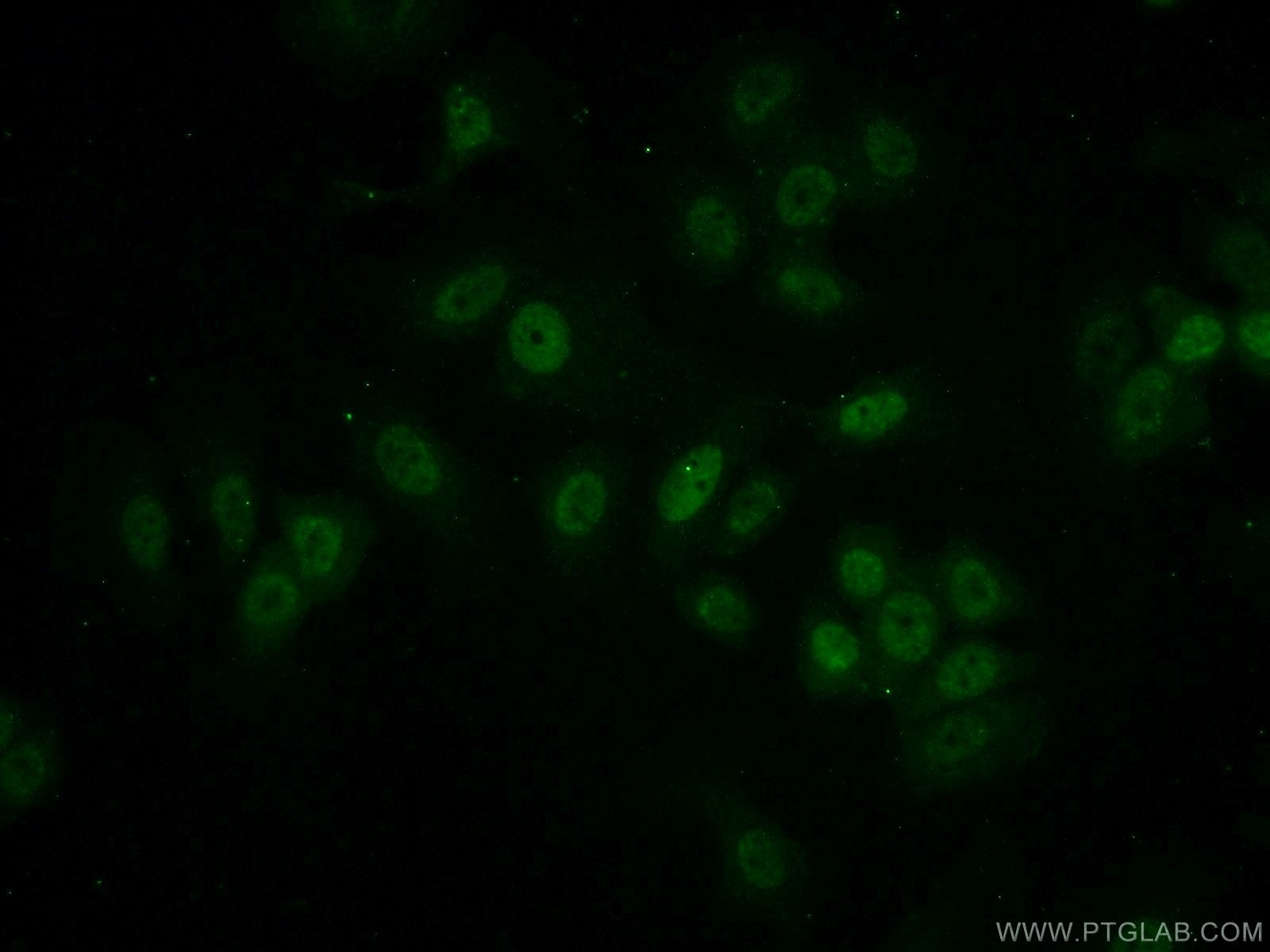 Immunofluorescence (IF) / fluorescent staining of MCF-7 cells using MEPCE Polyclonal antibody (14917-1-AP)