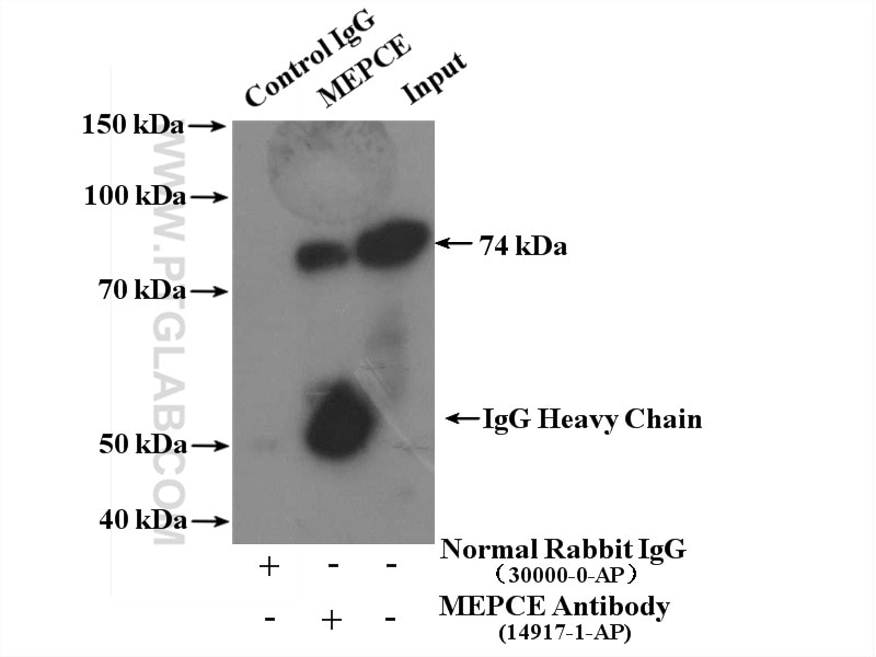 IP experiment of MCF-7 using 14917-1-AP