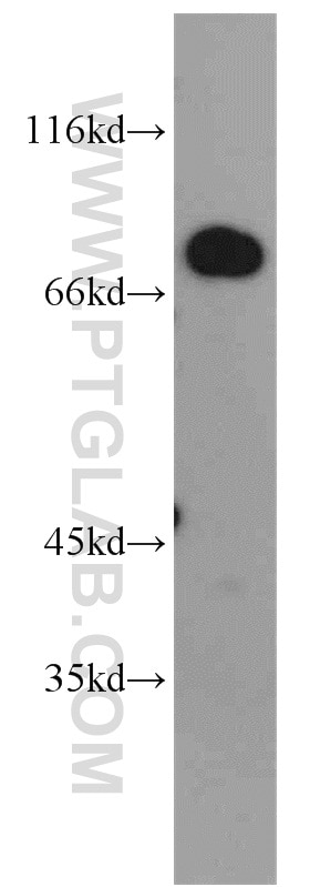 Western Blot (WB) analysis of MCF-7 cells using MEPCE Polyclonal antibody (14917-1-AP)