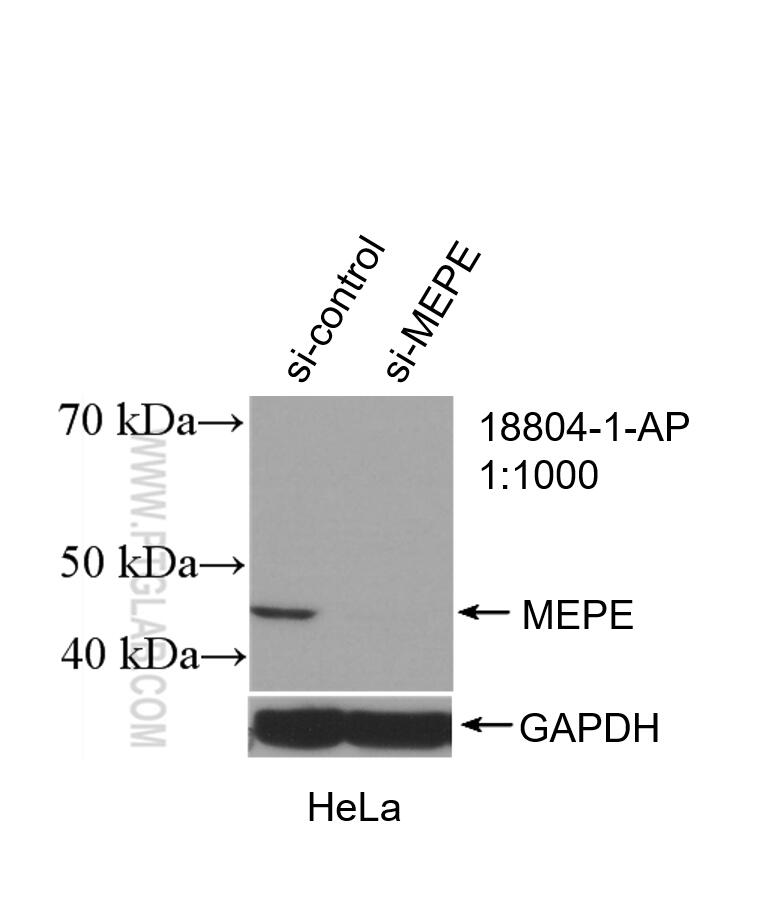 Western Blot (WB) analysis of HeLa cells using MEPE Polyclonal antibody (18804-1-AP)