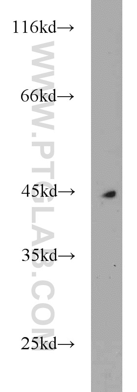 Western Blot (WB) analysis of A375 cells using MEPE Polyclonal antibody (18804-1-AP)