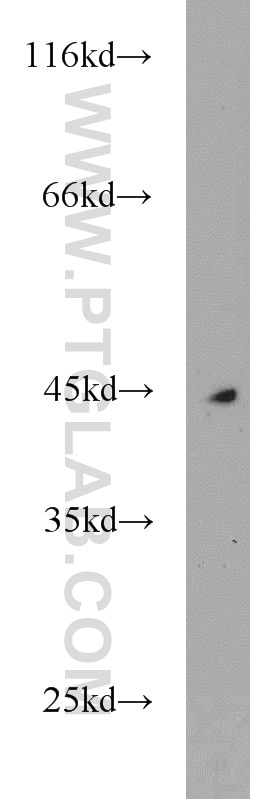 WB analysis of A375 using 18804-1-AP