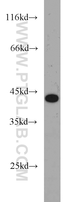 Western Blot (WB) analysis of MCF-7 cells using MEPE Polyclonal antibody (18804-1-AP)