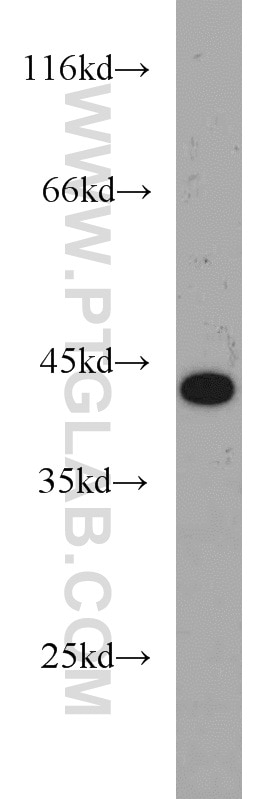 WB analysis of MCF-7 using 18804-1-AP