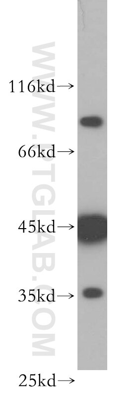 Western Blot (WB) analysis of HeLa cells using MEPE Polyclonal antibody (18804-1-AP)