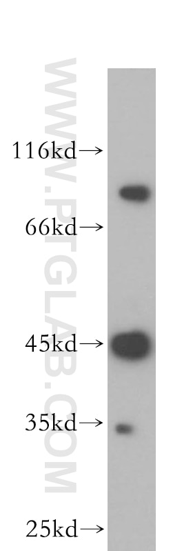 Western Blot (WB) analysis of HepG2 cells using MEPE Polyclonal antibody (18804-1-AP)