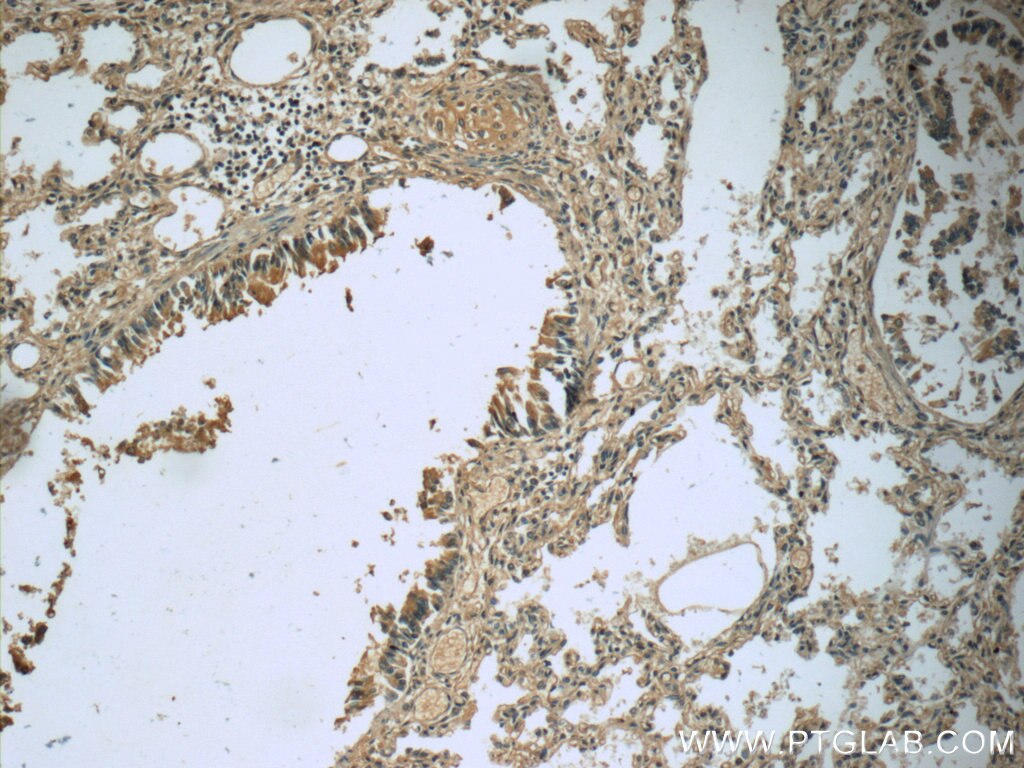 Immunohistochemistry (IHC) staining of human lung tissue using MEPE Polyclonal antibody (23256-1-AP)