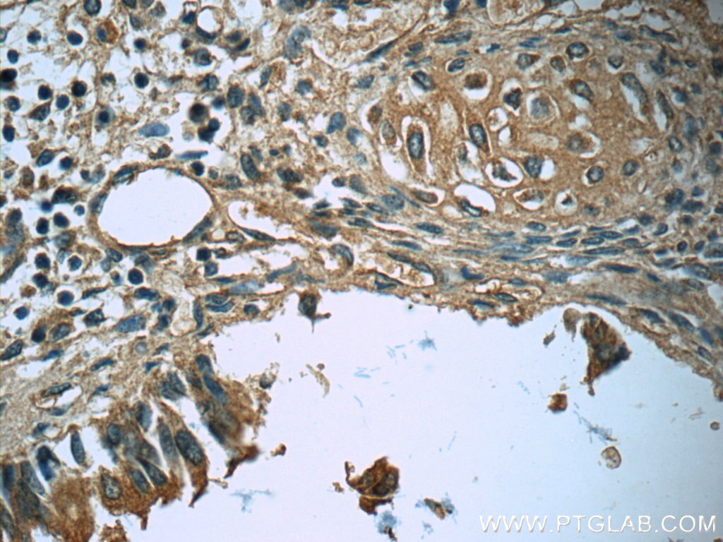 Immunohistochemistry (IHC) staining of human lung tissue using MEPE Polyclonal antibody (23256-1-AP)