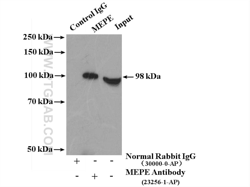 Immunoprecipitation (IP) experiment of HeLa cells using MEPE Polyclonal antibody (23256-1-AP)