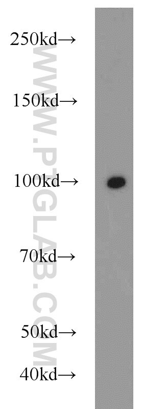 Western Blot (WB) analysis of HeLa cells using MEPE Polyclonal antibody (23256-1-AP)