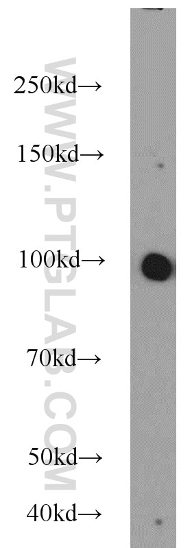 Western Blot (WB) analysis of MCF-7 cells using MEPE Polyclonal antibody (23256-1-AP)
