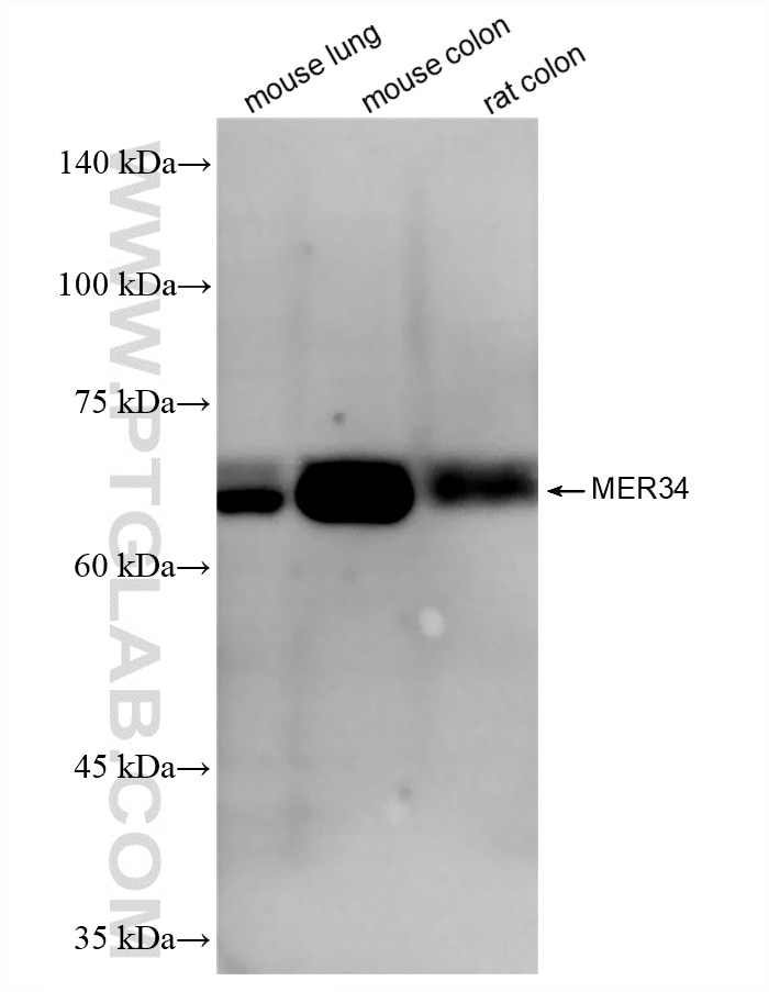 WB analysis using 86925-1-RR (same clone as 86925-1-PBS) Western Blot (WB) analysis of various lysates using MER34 Recombinant monoclonal antibody (86925-1-RR)