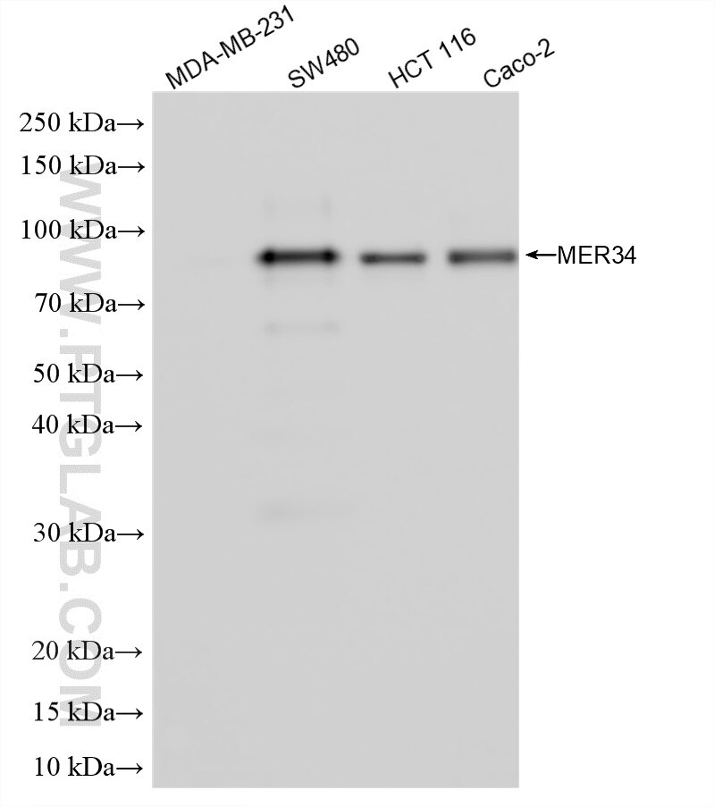 WB analysis using 86925-1-RR (same clone as 86925-1-PBS) Western Blot (WB) analysis of various lysates using MER34 Recombinant monoclonal antibody (86925-1-RR)