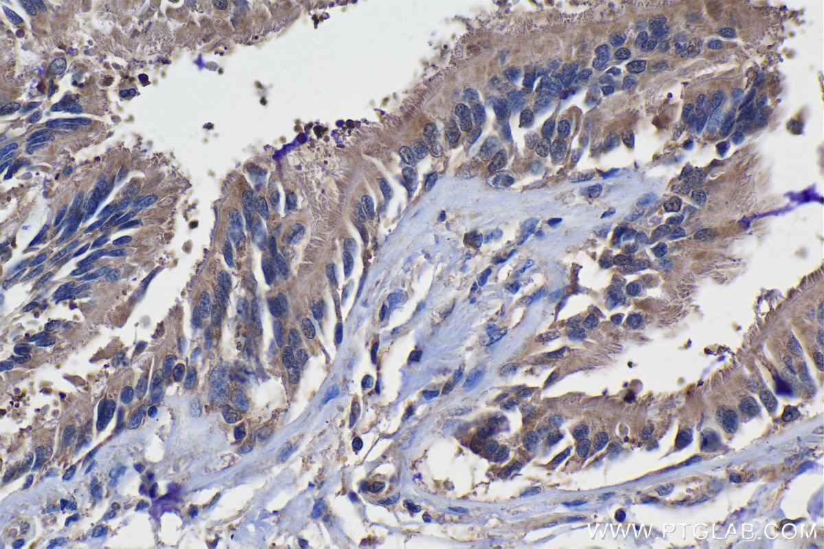 Immunohistochemistry (IHC) staining of human lung tissue using MERTK Polyclonal antibody (27900-1-AP)