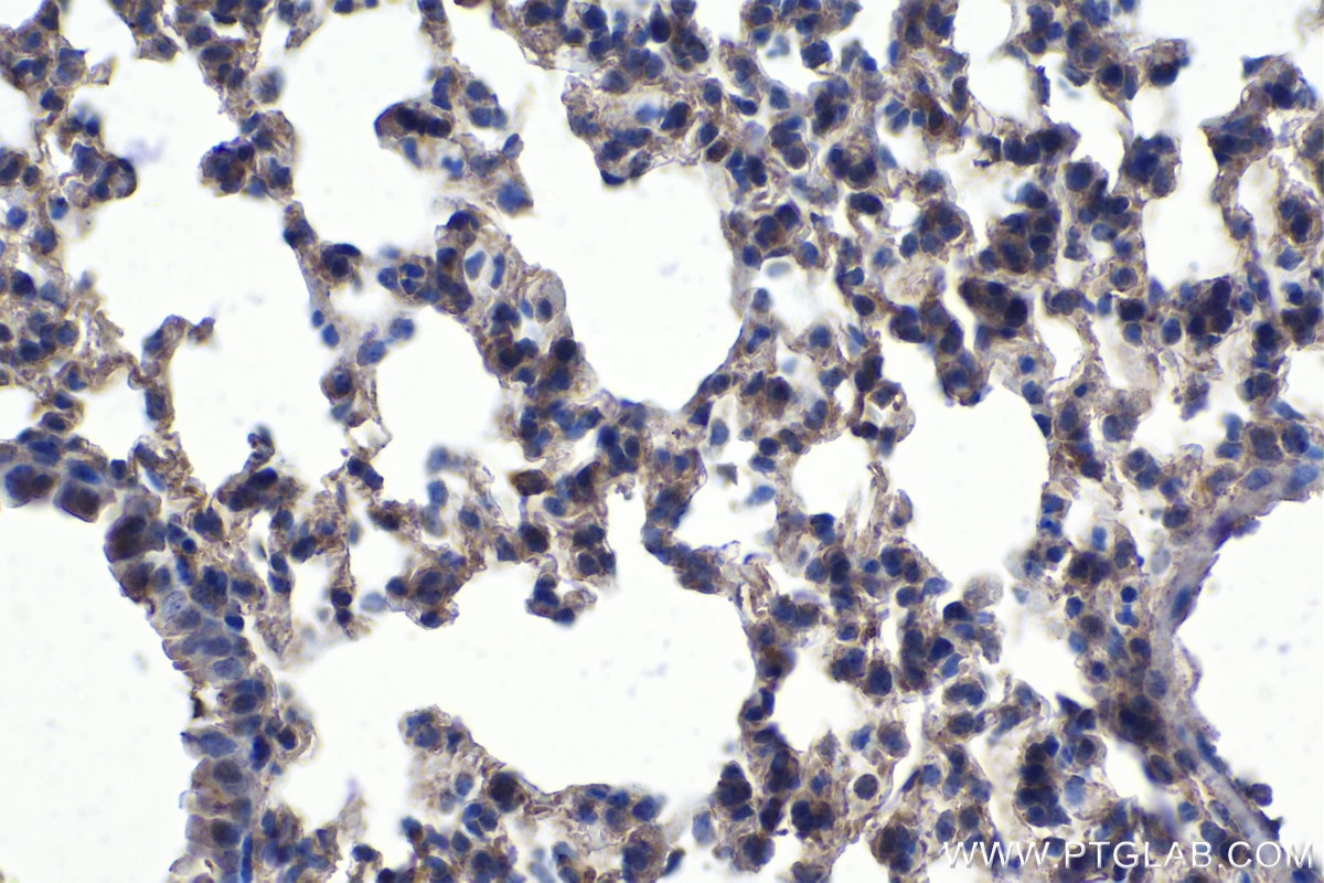Immunohistochemistry (IHC) staining of mouse lung tissue using MERTK Polyclonal antibody (27900-1-AP)