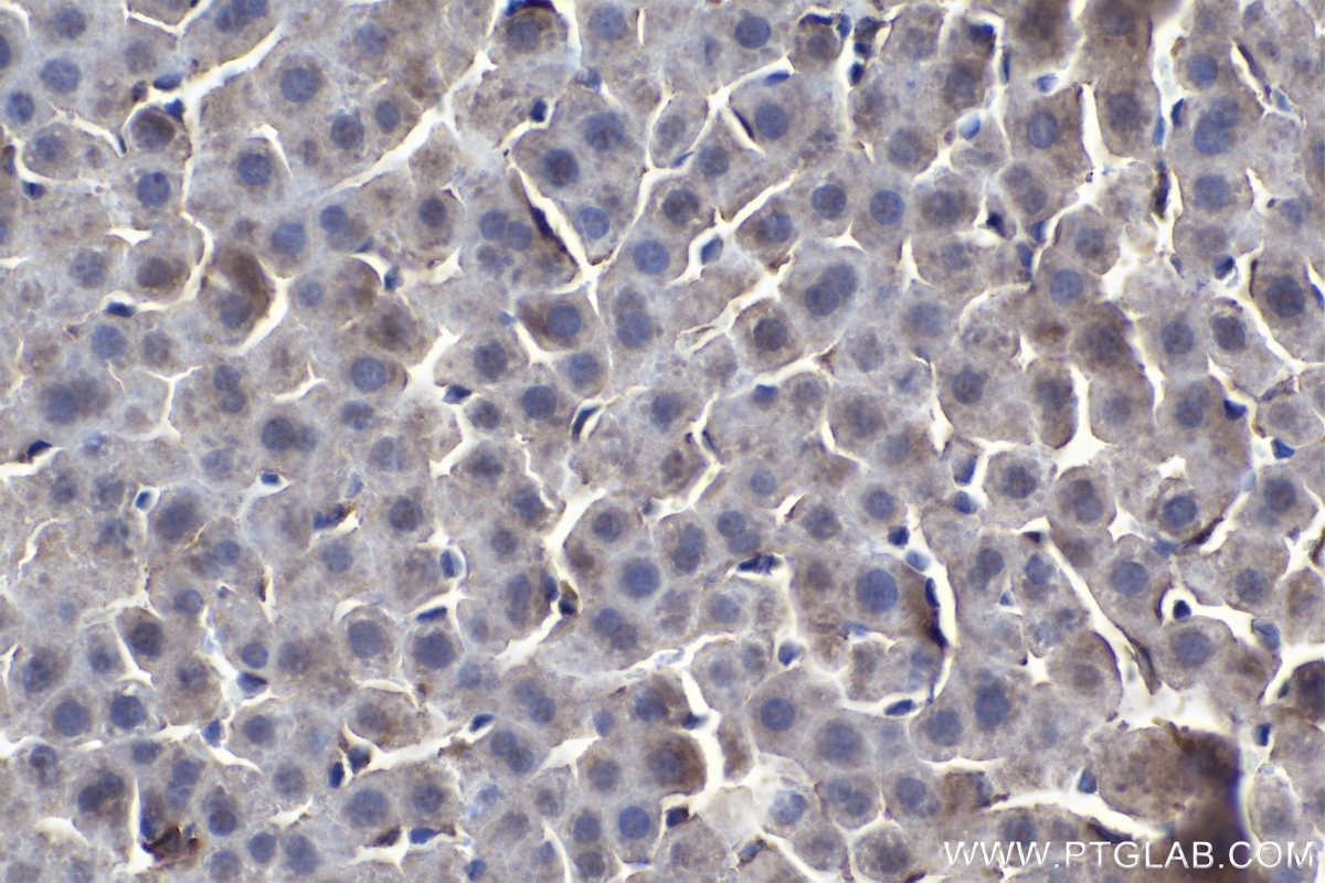 Immunohistochemistry (IHC) staining of rat liver tissue using MERTK Polyclonal antibody (27900-1-AP)