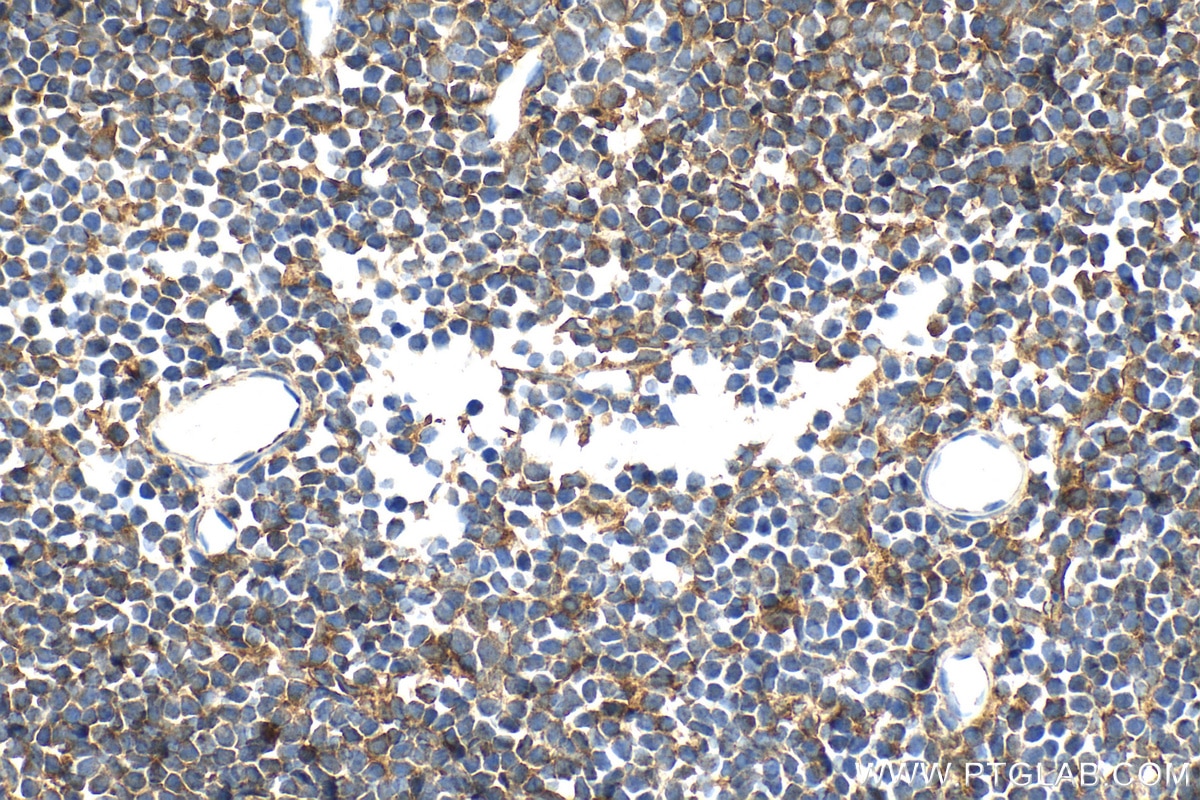 Immunohistochemical analysis of paraffin-embedded mouse spleen tissue slide using 27900-1-AP (MERTK antibody) at dilution of 1:800 (under 40x lens). Immunohistochemistry (IHC) staining of mouse spleen tissue using MERTK Polyclonal antibody (27900-1-AP)