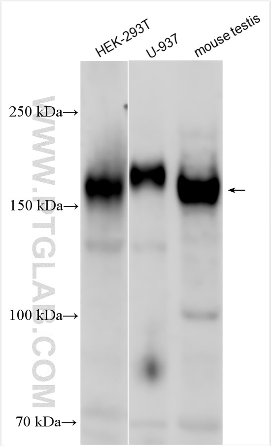Western Blot (WB) analysis of various lysates using MERTK Polyclonal antibody (27900-1-AP)