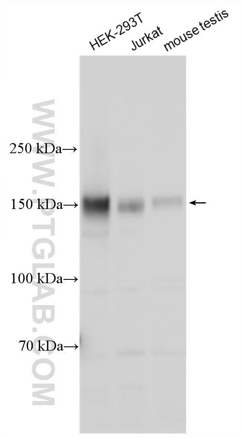 Various lysates were subjected to SDS PAGE followed by western blot with 27900-1-AP (MERTK antibody) at dilution of 1:1000 incubated at room temperature for 1.5 hours. Western Blot (WB) analysis of various lysates using MERTK Polyclonal antibody (27900-1-AP)