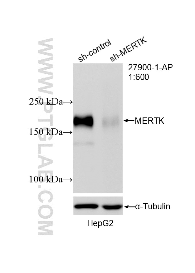 WB analysis of HepG2 using 27900-1-AP Western Blot (WB) analysis of HepG2 cells using MERTK Polyclonal antibody (27900-1-AP)