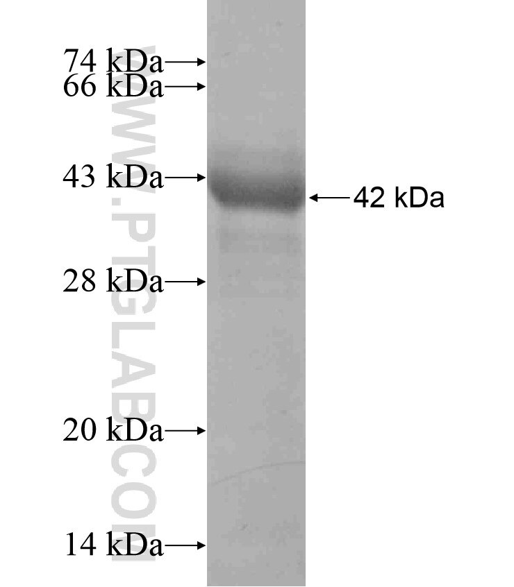 MERTK fusion protein Ag17401 SDS-PAGE