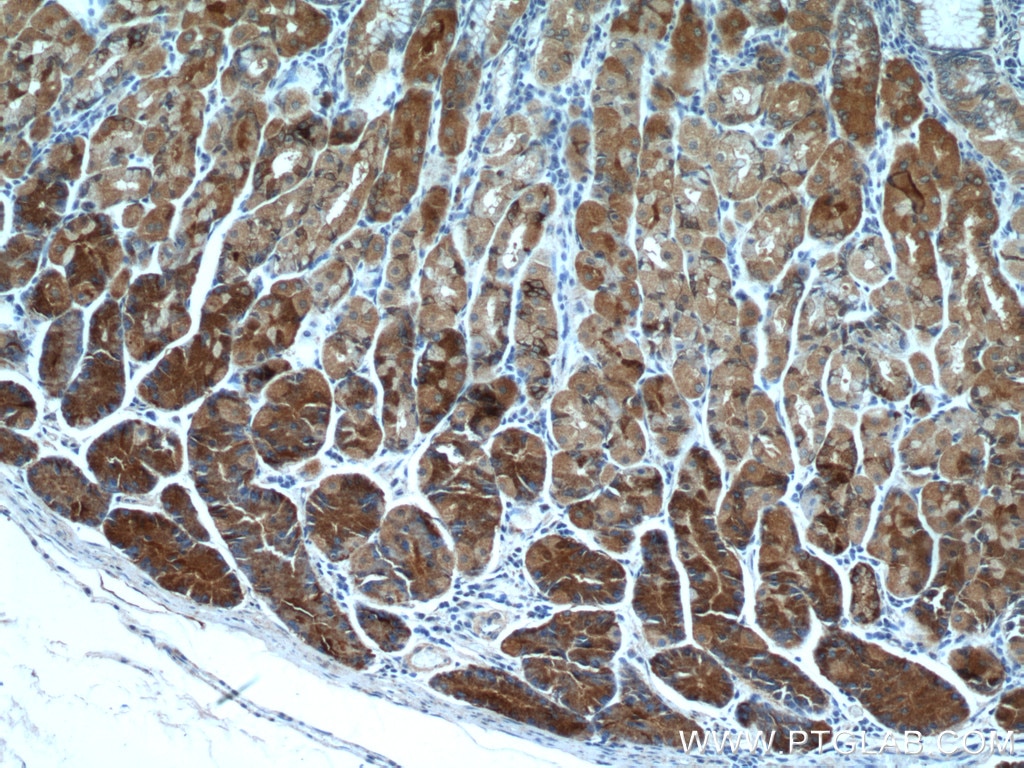 Immunohistochemistry (IHC) staining of human stomach tissue using MESDC2 Polyclonal antibody (10958-1-AP)