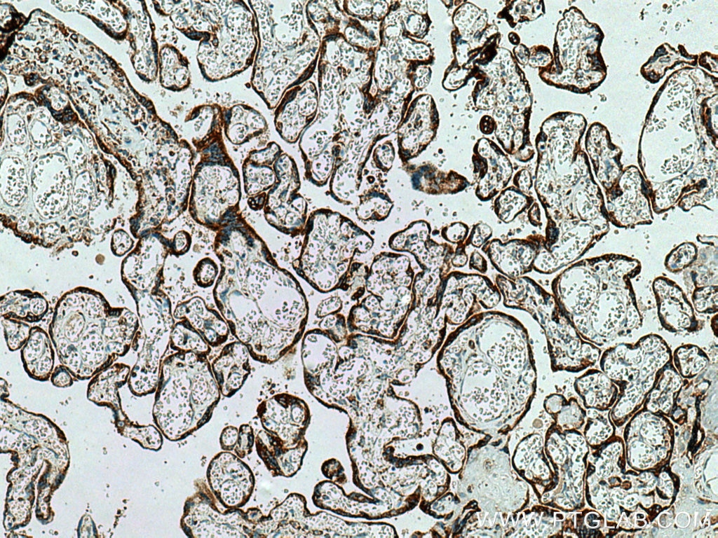 Immunohistochemistry (IHC) staining of human placenta tissue using MESDC2 Polyclonal antibody (10958-1-AP)