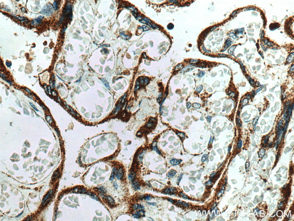 Immunohistochemistry (IHC) staining of human placenta tissue using MESDC2 Polyclonal antibody (10958-1-AP)