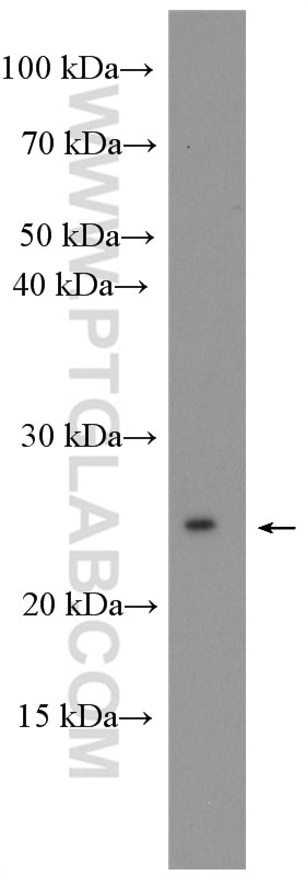 Western Blot (WB) analysis of HeLa cells using MESDC2 Polyclonal antibody (10958-1-AP)