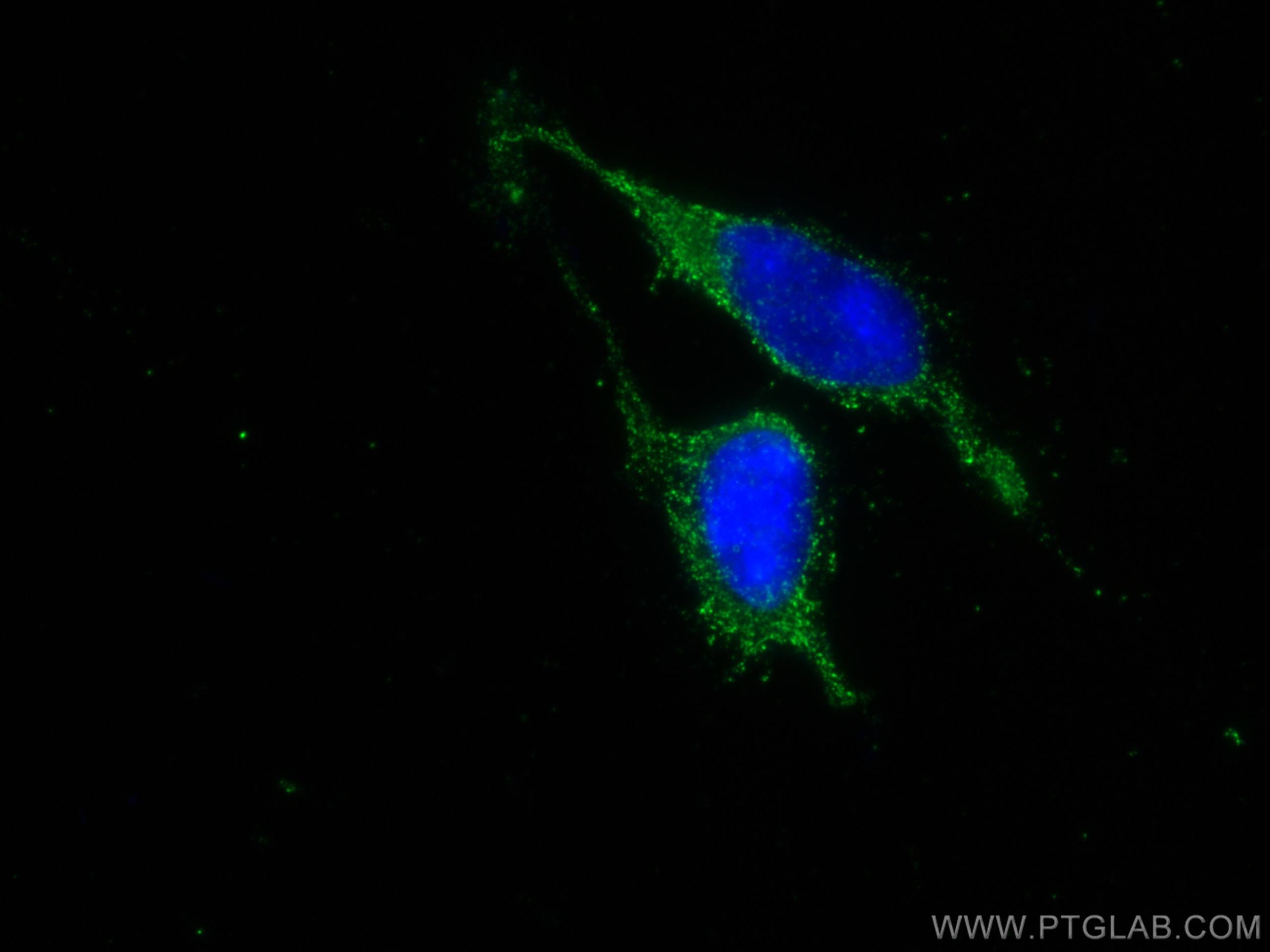 IF Staining of HEK-293 using 67441-1-Ig