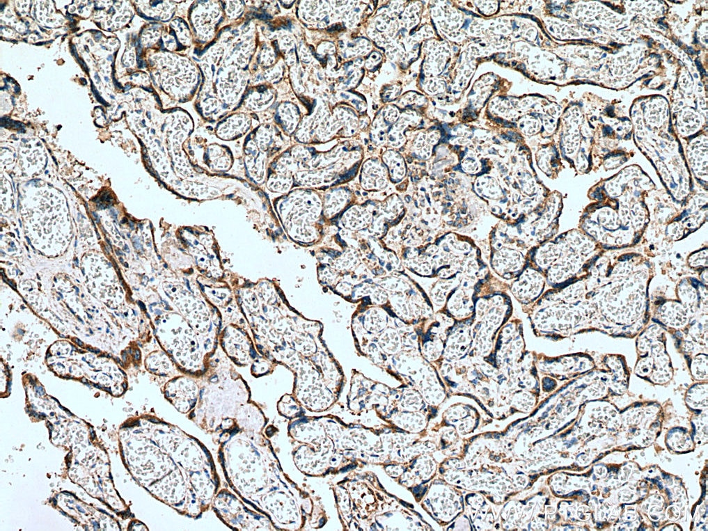 Immunohistochemistry (IHC) staining of human placenta tissue using MESDC2 Monoclonal antibody (67441-1-Ig)