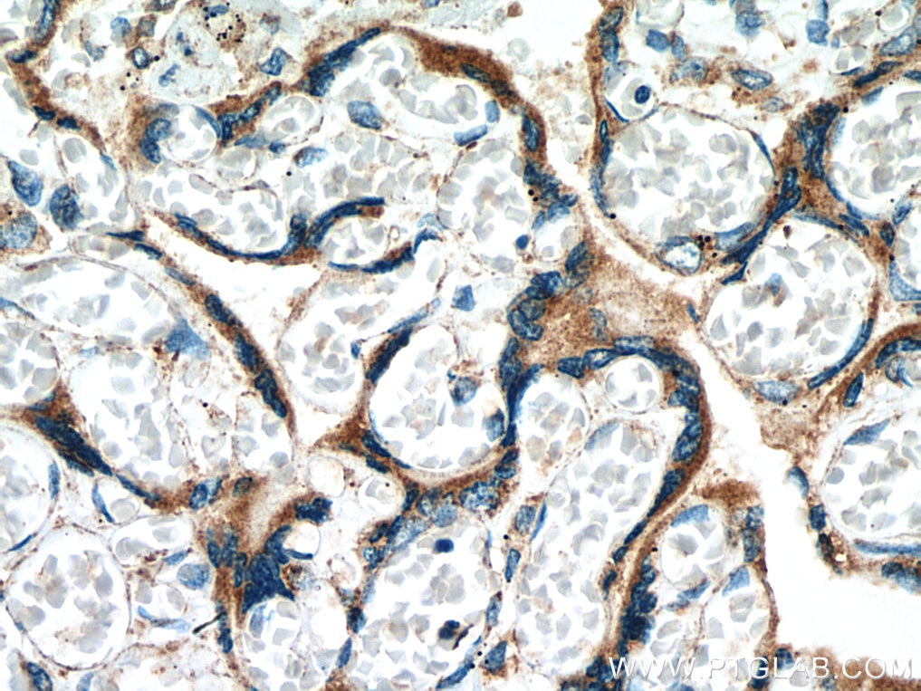 Immunohistochemistry (IHC) staining of human placenta tissue using MESDC2 Monoclonal antibody (67441-1-Ig)