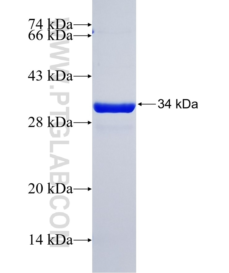 MESP1 fusion protein Ag38017 SDS-PAGE MESP1 fusion protein Ag38017 SDS-PAGE