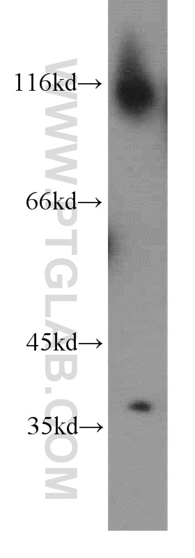 Western Blot (WB) analysis of human testis tissue using MEST Polyclonal antibody (11118-1-AP)