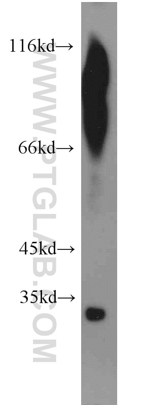 Western Blot (WB) analysis of human testis tissue using MEST Polyclonal antibody (11118-1-AP)