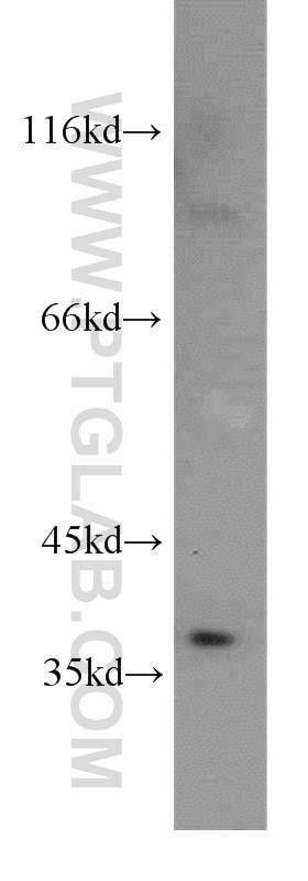 Western Blot (WB) analysis of human testis tissue using MEST Polyclonal antibody (11118-1-AP)