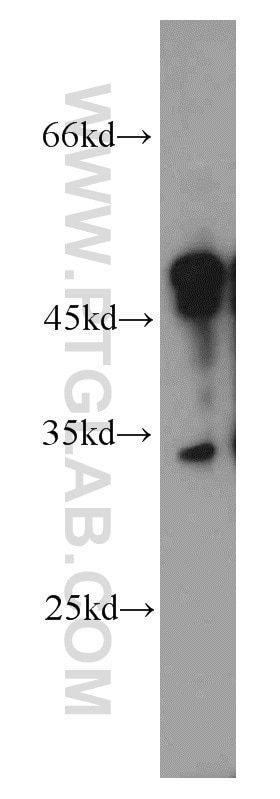 Western Blot (WB) analysis of PC-3 cells using MEST Polyclonal antibody (11118-1-AP)