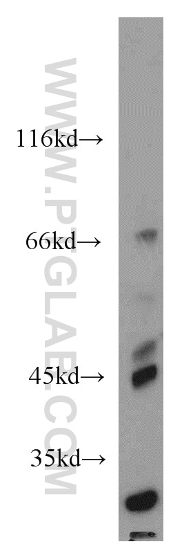 Western Blot (WB) analysis of mouse testis tissue using MEST Polyclonal antibody (11118-1-AP)