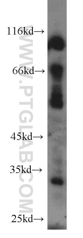 Western Blot (WB) analysis of human testis tissue using MEST Polyclonal antibody (11118-1-AP)