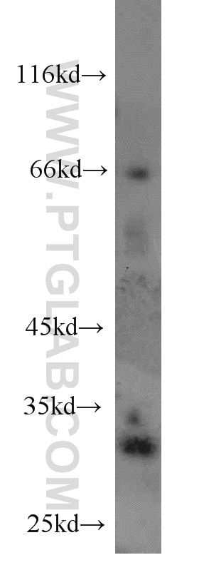 WB analysis of human testis using 11118-1-AP