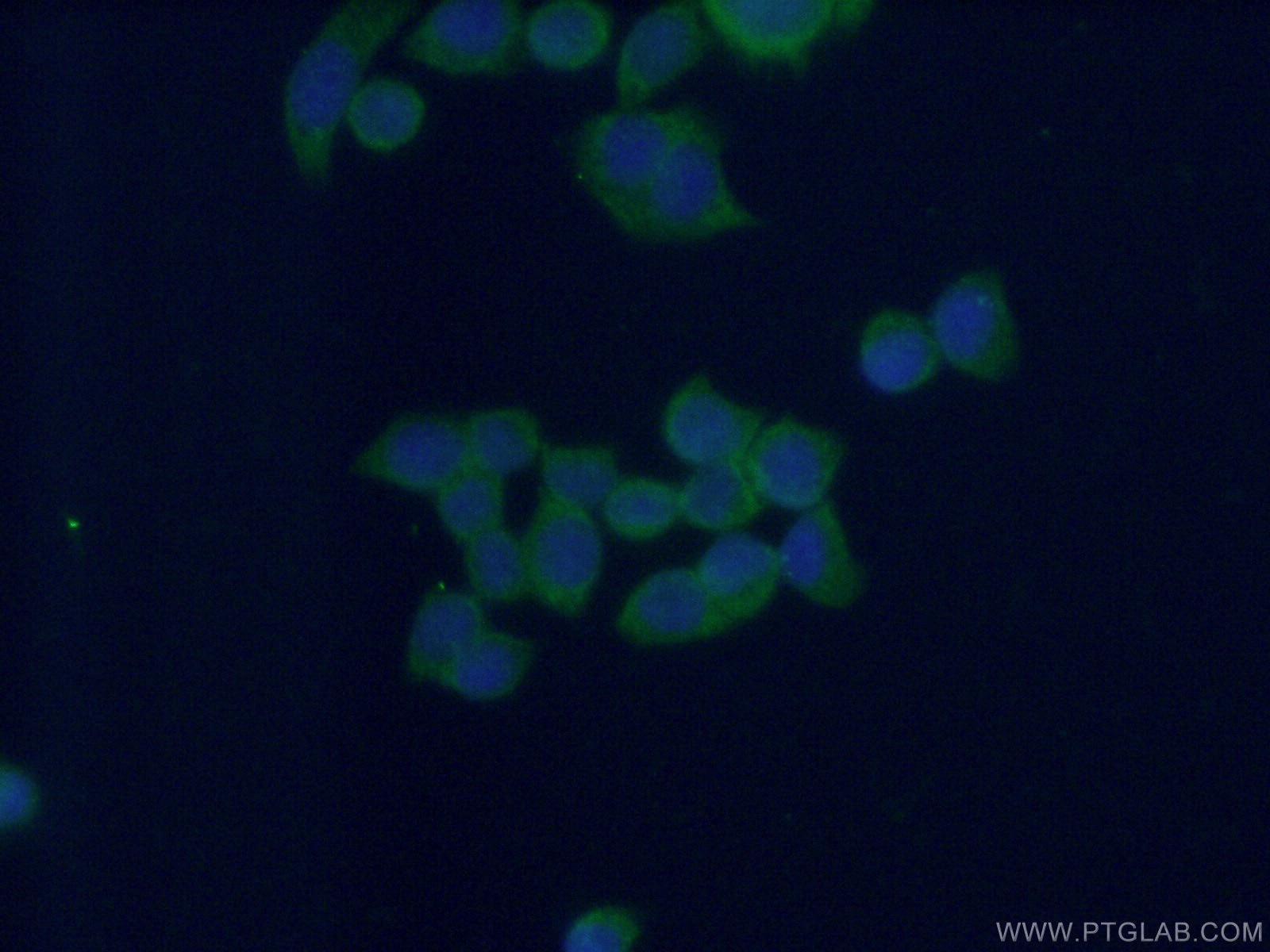Immunofluorescence (IF) / fluorescent staining of BxPC-3 cells using MEST Monoclonal antibody (60263-1-Ig)