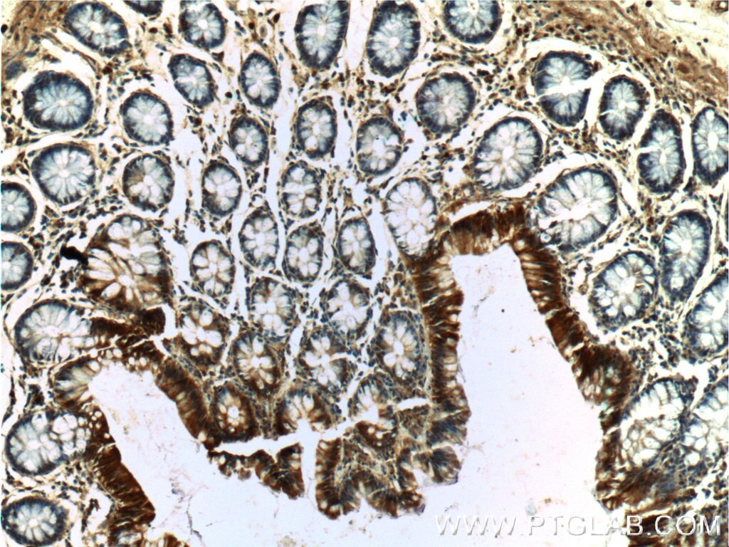 Immunohistochemistry (IHC) staining of human colon tissue using c-Met (N-terminal) Polyclonal antibody (19971-1-AP)