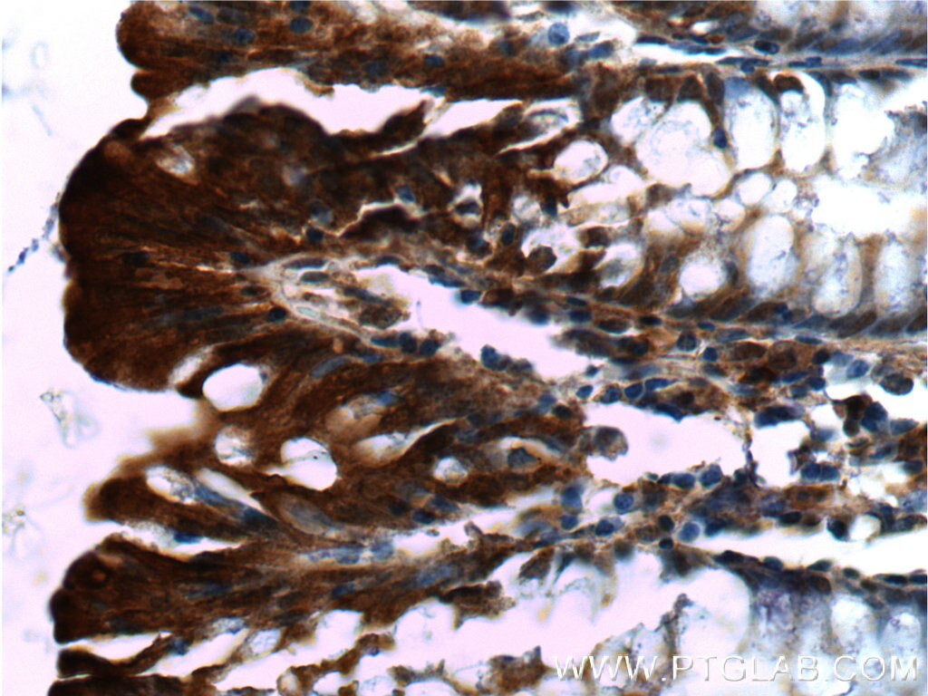 Immunohistochemistry (IHC) staining of human colon tissue using c-Met (N-terminal) Polyclonal antibody (19971-1-AP)