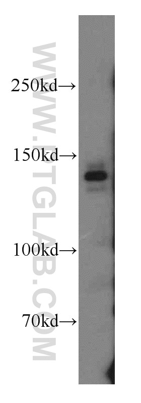 Western Blot (WB) analysis of HeLa cells using c-Met (N-terminal) Polyclonal antibody (19971-1-AP)