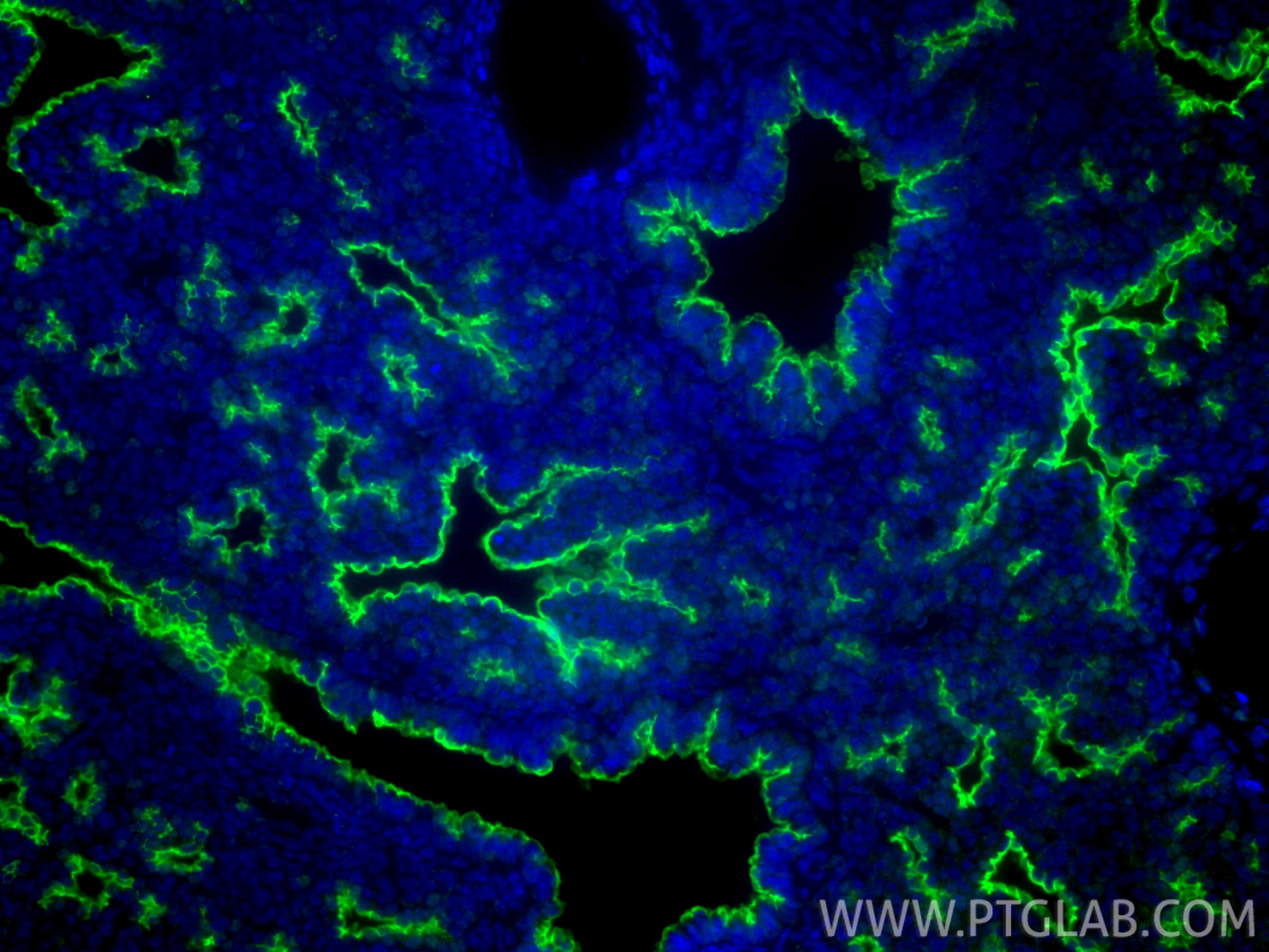 Immunofluorescence (IF) / fluorescent staining of mouse embryo tissue using c-Met (Cytoplasmic) Polyclonal antibody (25869-1-AP)