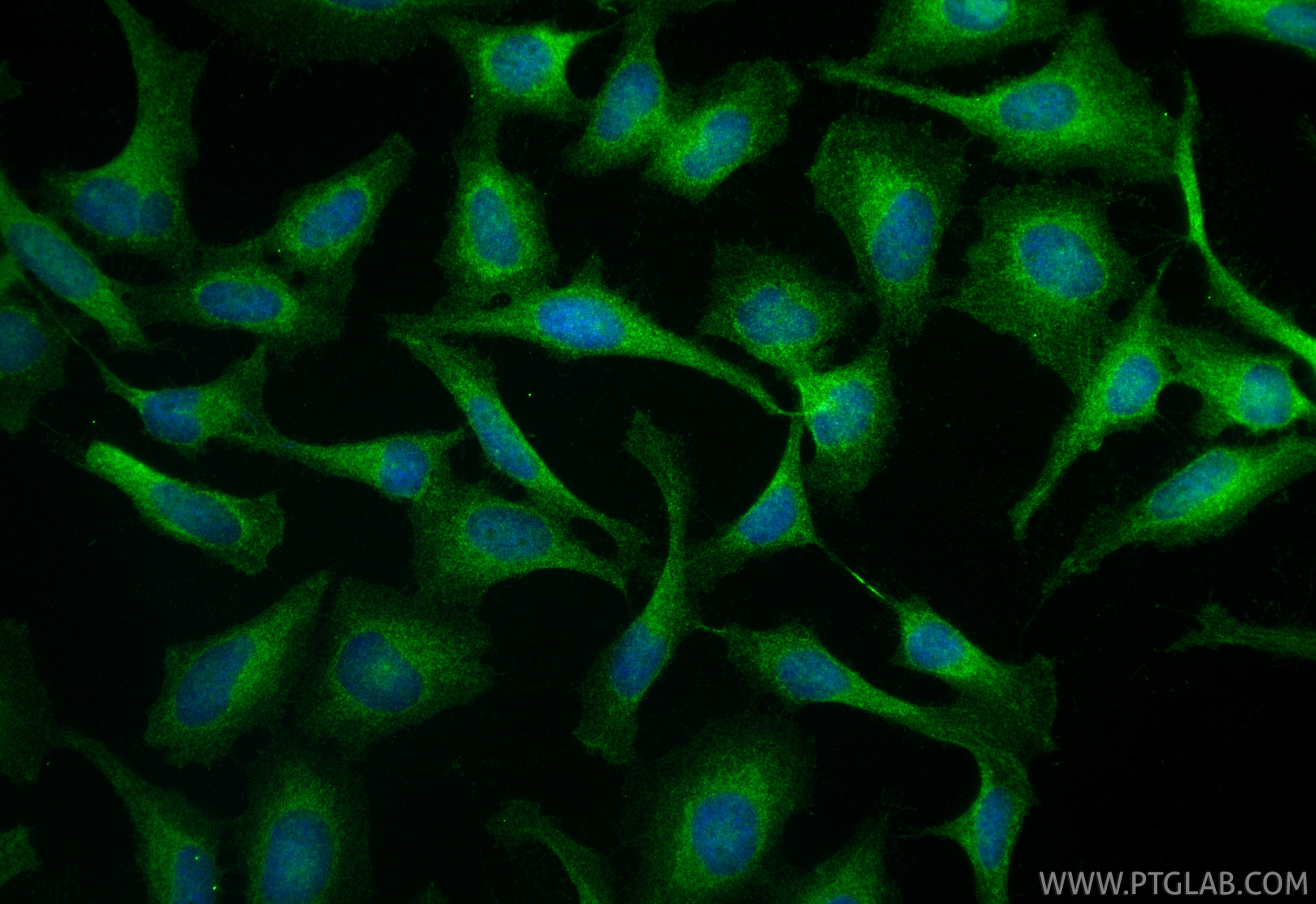 Immunofluorescent analysis of (4% PFA) fixed HeLa cells using c-Met (Cytoplasmic) antibody (25869-1-AP) at dilution of 1:200 and CoraLite®488-Conjugated Goat Anti-Rabbit IgG(H+L) (SA00013-2). Immunofluorescence (IF) / fluorescent staining of HeLa cells using c-Met (Cytoplasmic) Polyclonal antibody (25869-1-AP)