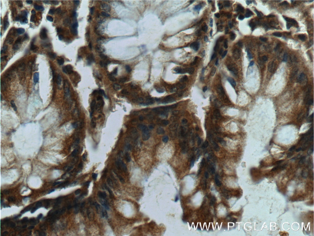 Immunohistochemistry (IHC) staining of human colon tissue using c-Met (Cytoplasmic) Polyclonal antibody (25869-1-AP)