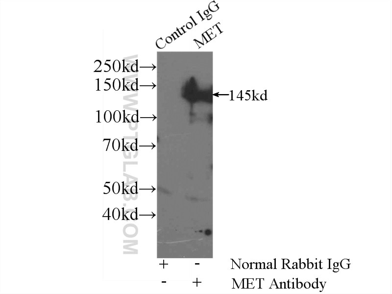 Immunoprecipitation (IP) experiment of HeLa cells using c-Met (Cytoplasmic) Polyclonal antibody (25869-1-AP)